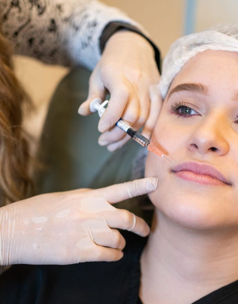 Preenchimento labial com ácido hialurônico